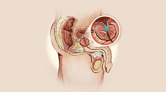 The prostate